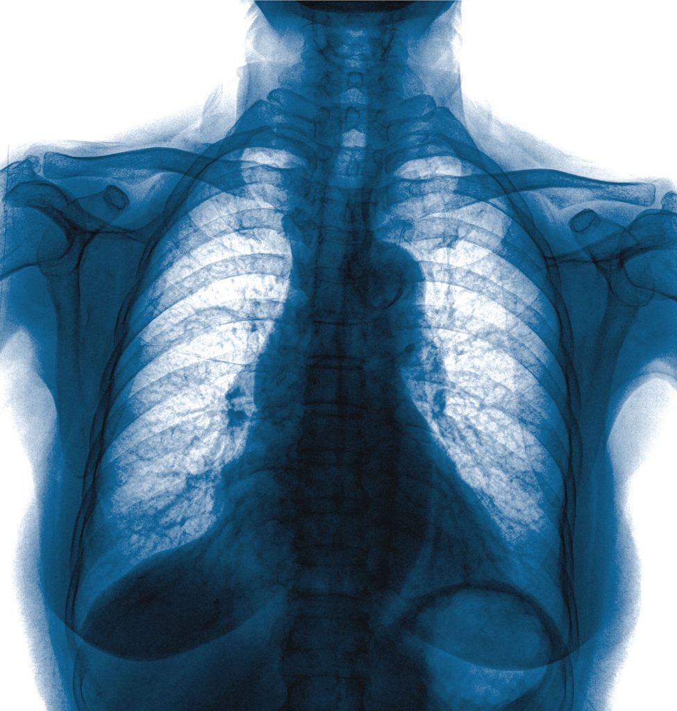 radiologia rayos x elche